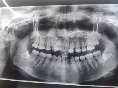 DENT2U83B6F6_Chandra_Dental_Clinic_ChIJ48AJEUsj8jkRhE8-bHLLI9M_5