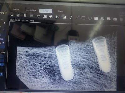 DENT2U83B6F6_Chandra_Dental_Clinic_ChIJ48AJEUsj8jkRhE8-bHLLI9M_7