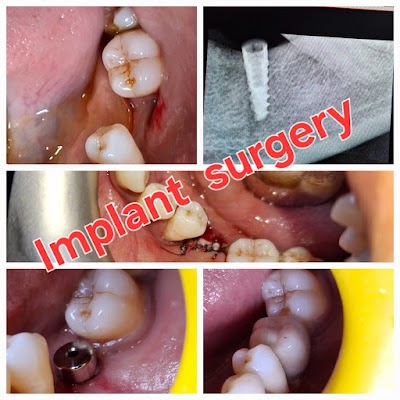 DENT9N7YTE8W_Usha_Dental_Clinic___Implant_centre_ChIJzcOEzygb8jkRWEZDfzg2d5U_5