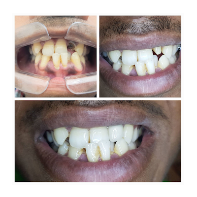 DENTI2VDO2NA_DA_Dental_Clinic_ChIJZ0uMkdwd8jkR3Hwpui55Khw_1