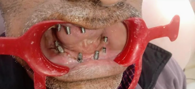 DENTI2VDO2NA_DA_Dental_Clinic_ChIJZ0uMkdwd8jkR3Hwpui55Khw_9