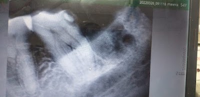 DENTOV8BNYID_Vishwanath_Oro_Dental_Care_ChIJdeRSgE098jkRwlIOlzUQGCY_10