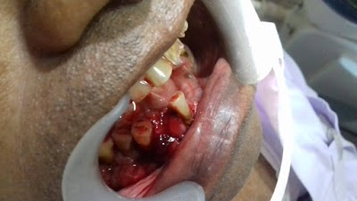 DENTOV8BNYID_Vishwanath_Oro_Dental_Care_ChIJdeRSgE098jkRwlIOlzUQGCY_3