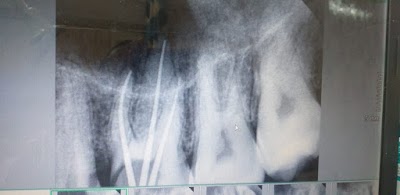 DENTOV8BNYID_Vishwanath_Oro_Dental_Care_ChIJdeRSgE098jkRwlIOlzUQGCY_5