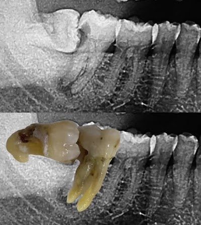 DENTPO91CC3V_Usha_Dental_Clinic_ChIJsTGk079t8jkRZgRfEKAQolE_4
