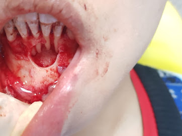 DENTPO91CC3V_Usha_Dental_Clinic_ChIJsTGk079t8jkRZgRfEKAQolE_7