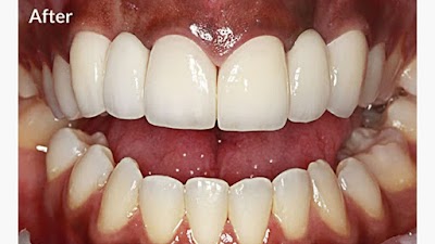 DENTU7OMQAB3_Manipal_Dental_care.Dr_Ganesh_GAURAV_ChIJI-JF7xUj8jkRxhhJTBmLCOc_1