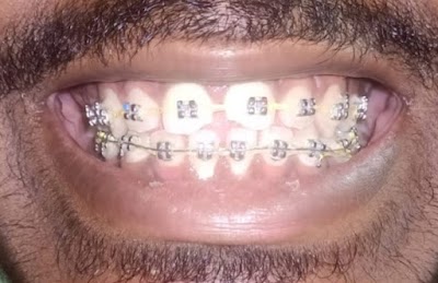 DENTVGSK35MG_ORAL_DENTAL_CLINIC_JAMUI_ChIJLcicGpEr8jkRSwNCvHi96CI_8