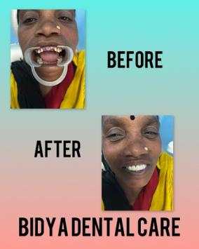 DENTAE2JHFKW_Bidya_multispeciality_dental_clinic_ChIJv8VYNmkx8jkR4SQVGzsbCdw_7