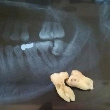 DENTPO91CC3V_Usha_Dental_Clinic_ChIJsTGk079t8jkRZgRfEKAQolE_6