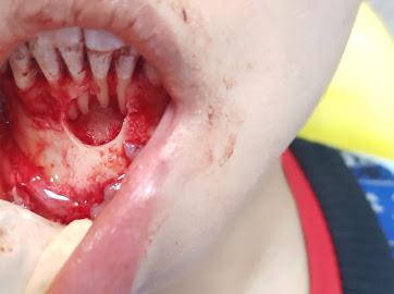 DENTPO91CC3V_Usha_Dental_Clinic_ChIJsTGk079t8jkRZgRfEKAQolE_7