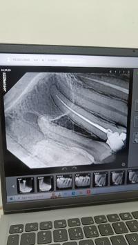 DENTX2RAC037_Dr_Ashish_S_and_Rajni_B_-_Maa_Gayatri_Dental_Clinic_-_RCT_and_Implant_Specialist_ChIJI0xYhssa8jkRGB7Sf0Zcoew_10